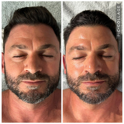 🔥 BLACK FRIDAY WEEK – OFFERTA IMPERDIBILE – TRATTAMENTO VISO 🔥