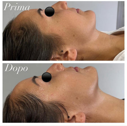 🔥 BLACK FRIDAY WEEK – OFFERTA IMPERDIBILE – TRATTAMENTO VISO 🔥