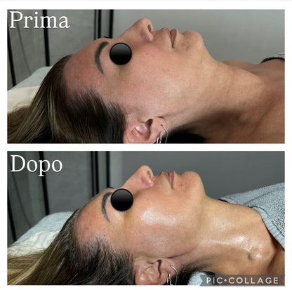 🔥 BLACK FRIDAY WEEK – OFFERTA IMPERDIBILE – TRATTAMENTO VISO 🔥