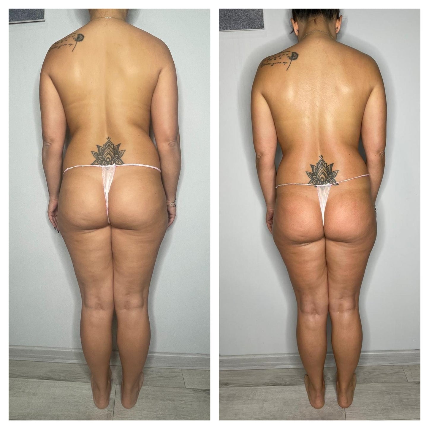 🔥 BLACK FRIDAY WEEK – OFFERTA IMPERDIBILE – TRATTAMENTO CORPO 🔥