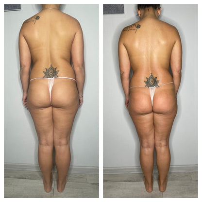 🔥 BLACK FRIDAY WEEK – OFFERTA IMPERDIBILE – TRATTAMENTO CORPO 🔥