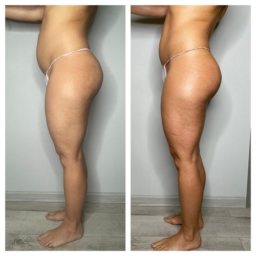 🔥 BLACK FRIDAY WEEK – OFFERTA IMPERDIBILE – TRATTAMENTO CORPO 🔥