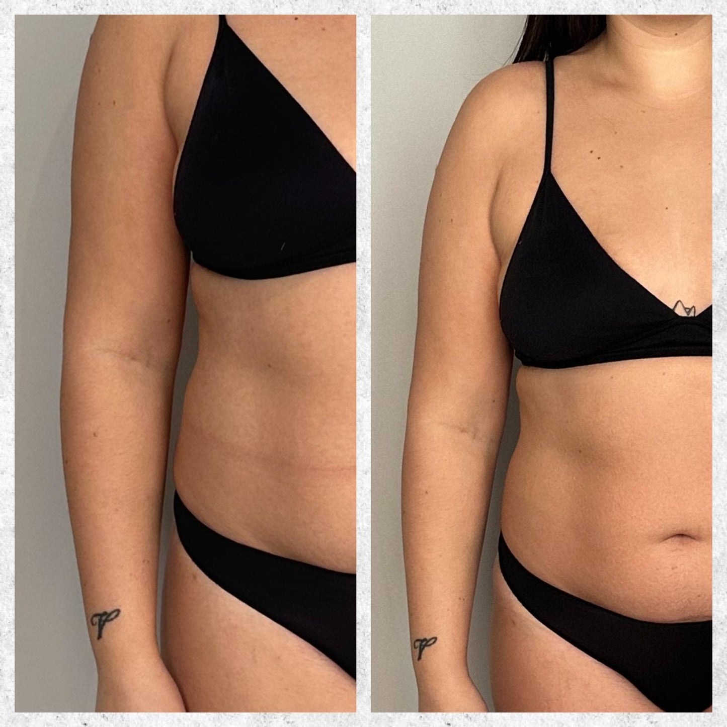 🔥 BLACK FRIDAY WEEK – OFFERTA IMPERDIBILE – TRATTAMENTO CORPO 🔥